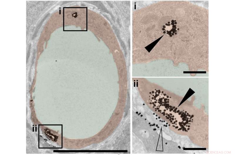 Engineered Nanoparticles Prefer Cellular Uptake to Paracellular Passage in Tumors