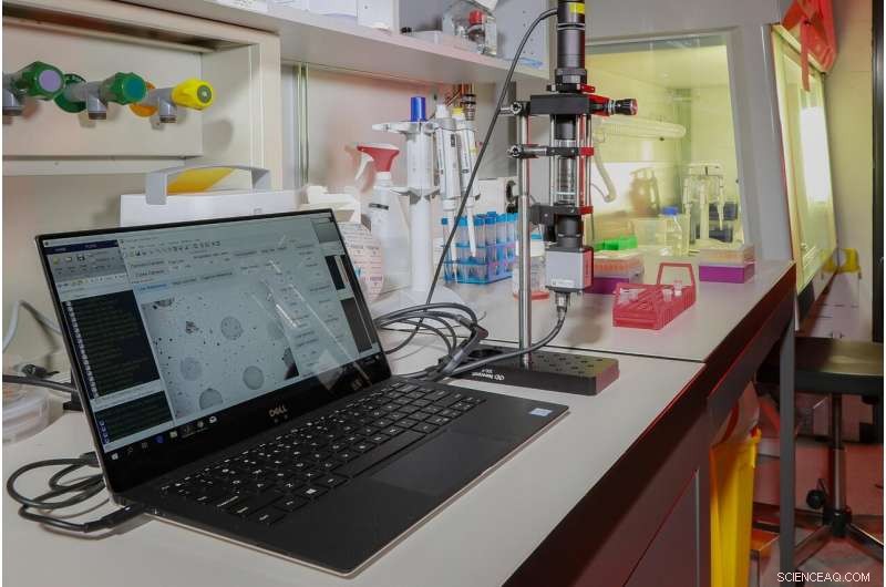 Portable Biosensor Accelerates Sepsis Diagnosis, Enhancing Patient Outcomes