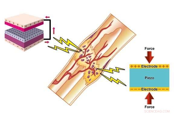 Harnessing Bone’s Natural Electrical Properties for Enhanced Regeneration