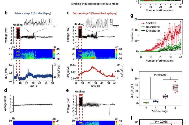 Highly Sensitive Potassium Nanosensors for Accurate Epileptic Seizure Detection