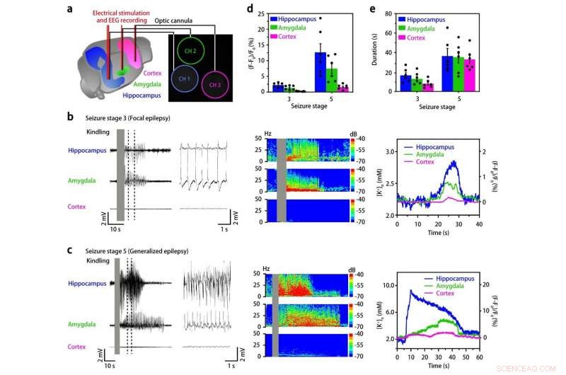 Highly Sensitive Potassium Nanosensors for Accurate Epileptic Seizure Detection