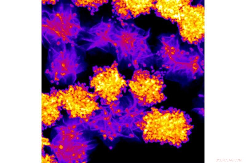 The Crucial Role of Interfaces in Bonding Noble Metals to 2‑D Materials