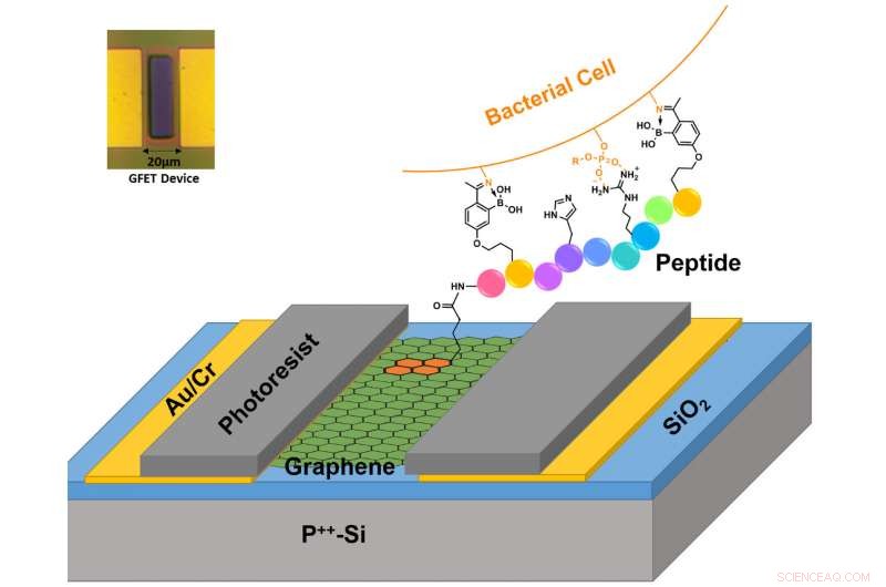 Graphene‑Based Sensor Quickly Identifies Antibiotic‑Resistant Bacterial Strains