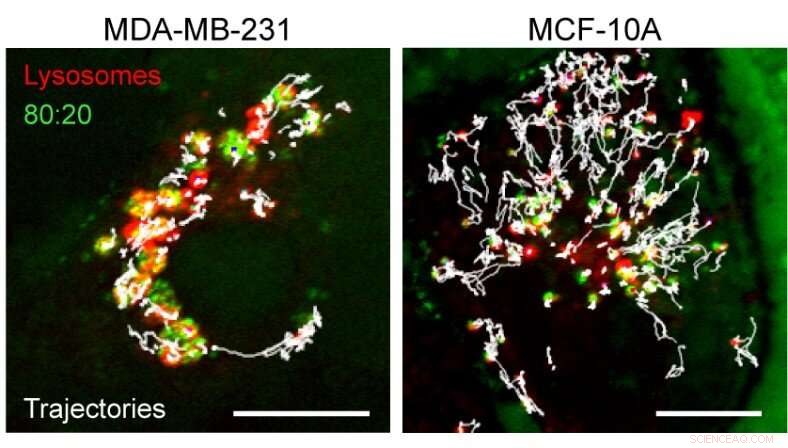 Targeted Cancer Cell Elimination via Nanoparticle‑Induced Lysosomal Disruption