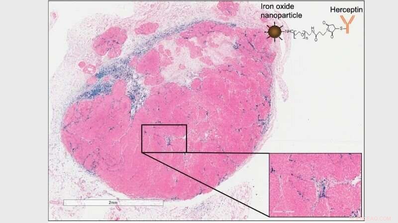 Study Reveals Most Effective Nanoparticle Delivery Strategy for Cancer Treatment