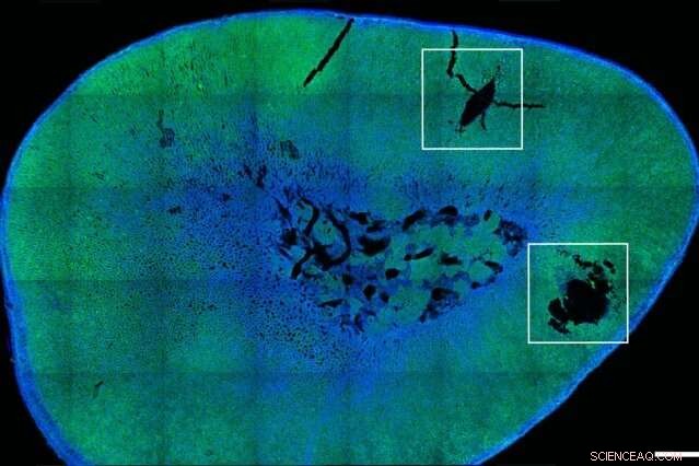 MIT Engineers Develop Magnetic Nanoparticles for Remote Hormone Release Control