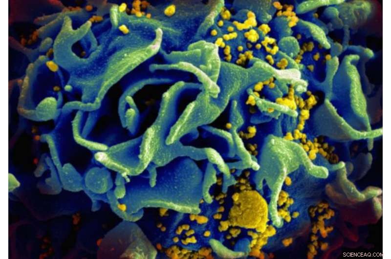 Decoy Nanoparticles Prevent HIV Infection: Innovative Nanosponge Technology