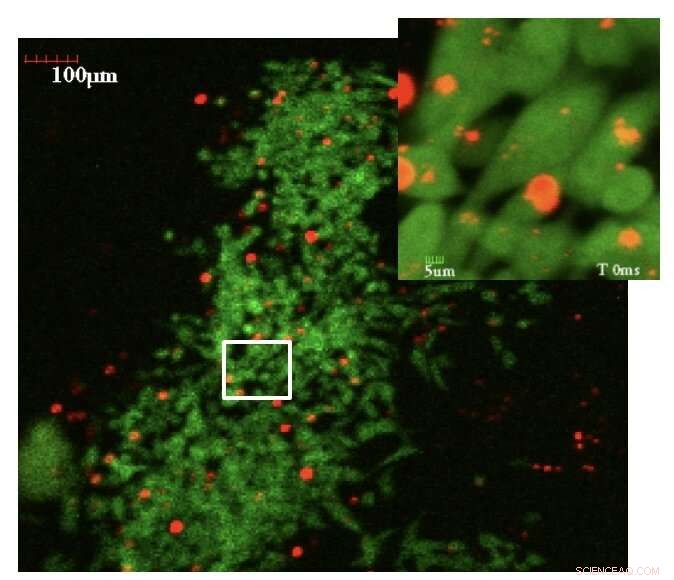Scientists Use Nanoparticles to Map Cancer Cell Mechanics In Vivo
