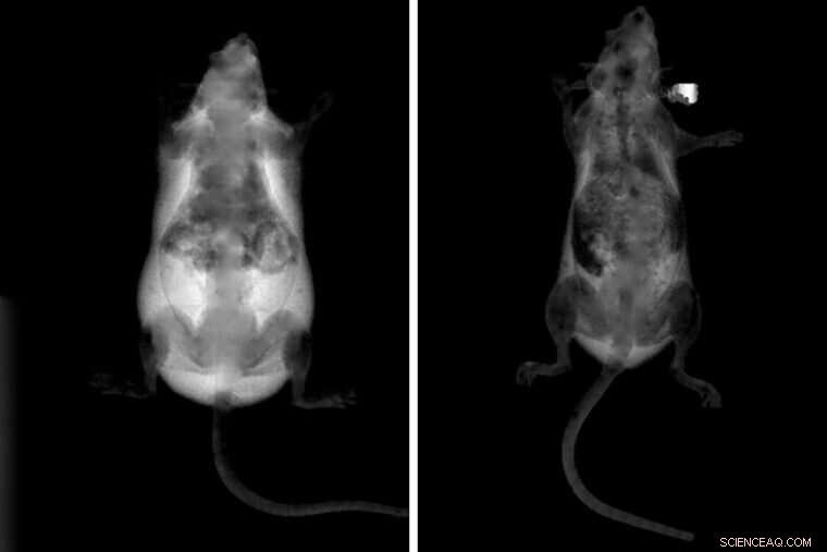 Gene-Disabling Nanoparticles Halt Obesity in High-Fat Diet Mice