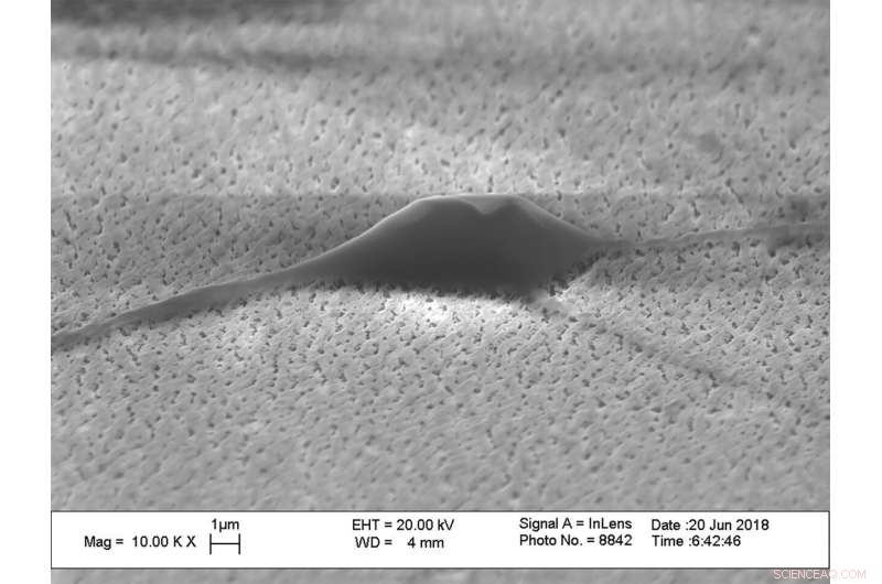 Innovative Nanostructure Promotes Neural Stem Cell Differentiation for Parkinson s Disease Therapy