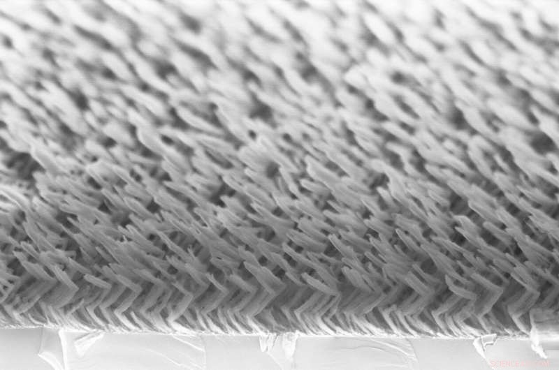 Innovative Nanostructure Promotes Neural Stem Cell Differentiation for Parkinson s Disease Therapy