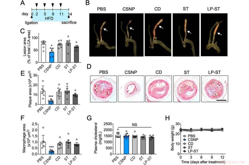 KAIST Develops Innovative Nanoparticle Combination Therapy for Atherosclerosis