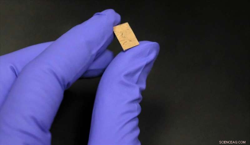 New Urine Test Predicts Outcomes After Threatened Miscarriage