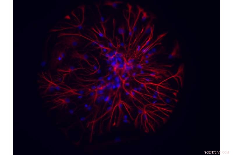 Gold Nanoparticles Protect Neurons from Excitotoxic Death