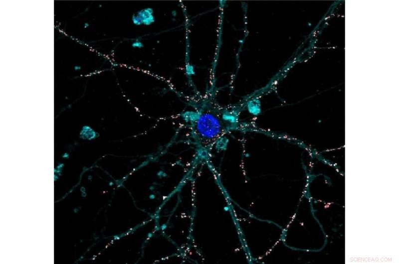 Revolutionary Liquid Retinal Prosthesis: Nanotech Breakthrough for Vision Restoration