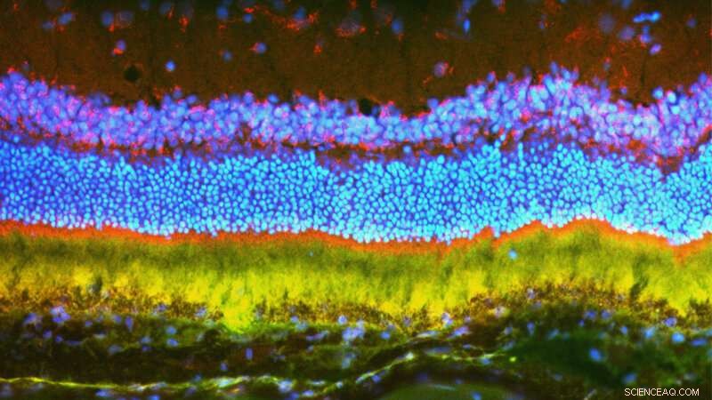 Nanoparticle‑Delivered Gene Therapy Stops Blinding Eye Disease in Rodents