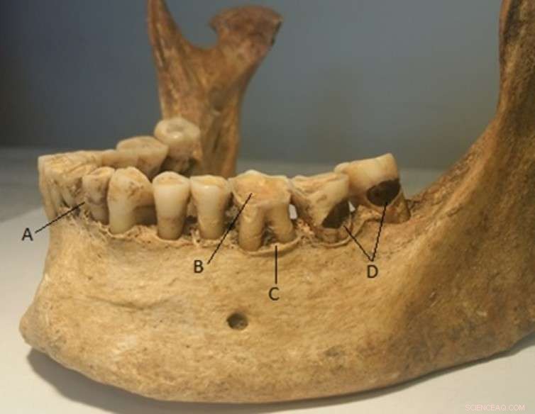 Uncovering Our Ancestors: How Teeth Reveal Their Secret Lives