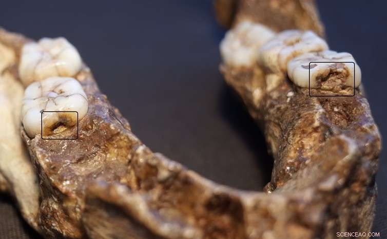 Uncovering Our Ancestors: How Teeth Reveal Their Secret Lives