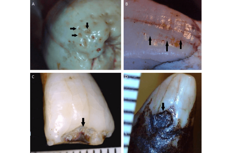 Uncovering Our Ancestors: How Teeth Reveal Their Secret Lives