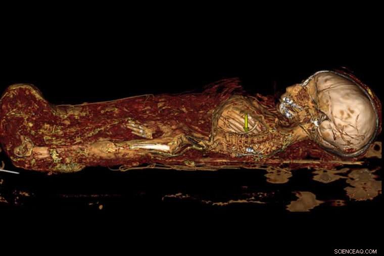 Ancient Insights: Baby Mummy and Dinosaur Skulls Scanned with CT Technology