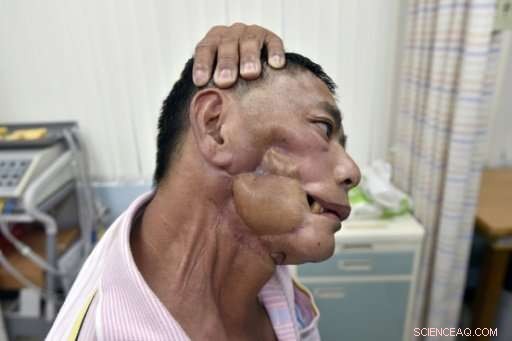 Taiwan’s Initiative to Curb Betel Nut Addiction by Replacing Cultivation with Alternative Crops