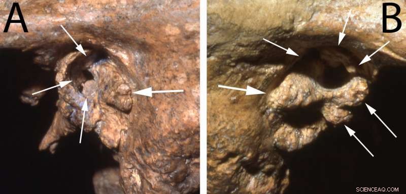 Neanderthal Survives Into His 40s With Community Support, New Study Shows