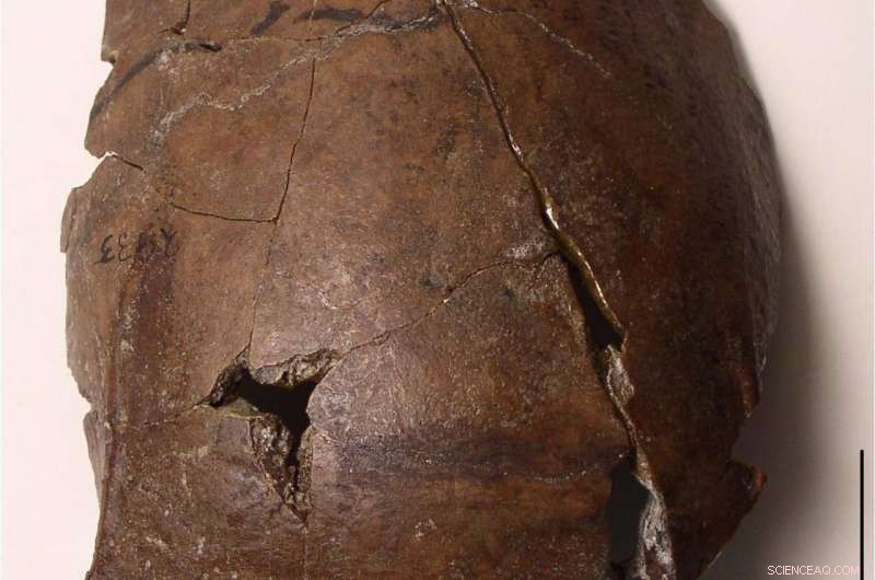 Aitape Skull Found: Possible First Recorded Tsunami Victim from 6,000 Years Ago