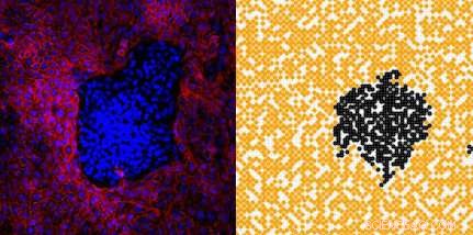 Mathematical Model Mimics Melanoma Growth Patterns