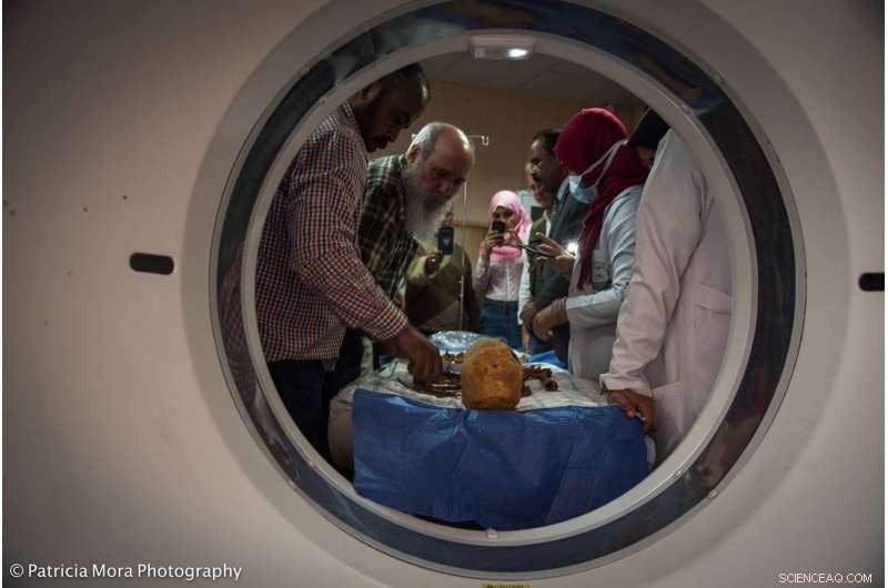 Ancient Mummies Reveal Earliest Known Breast Cancer and Myeloma Cases via CT Scans