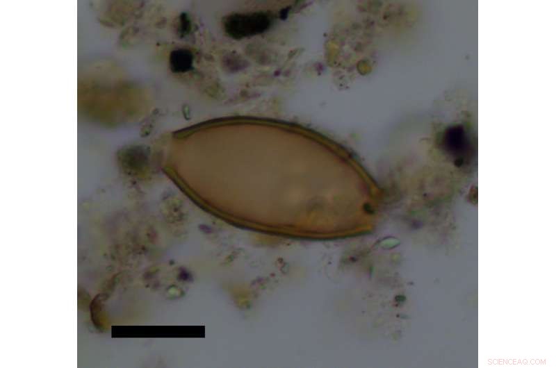 Ancient Greek Feces Confirm Whipworm Parasites First Mentioned by Hippocrates