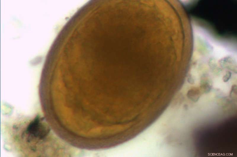 Ancient Greek Feces Confirm Whipworm Parasites First Mentioned by Hippocrates