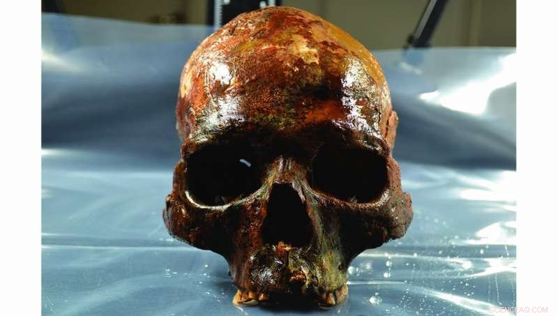 8000-Year-Old Underwater Grave Discovered in Sweden, Showcasing Skulls Mounted on Poles