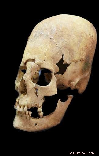 Skull Evidence Reveals Women Migrated Across Medieval Europe, Not Only Men