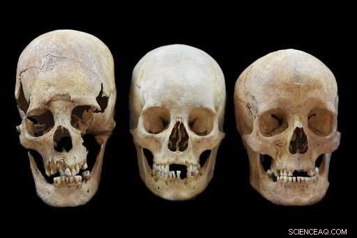 Skull Evidence Reveals Women Migrated Across Medieval Europe, Not Only Men