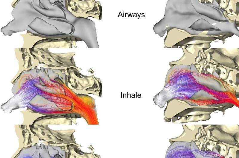 Neanderthal Nasal Adaptations: How Their Protruding Nose Helped Them Breathe in Arctic Winters
