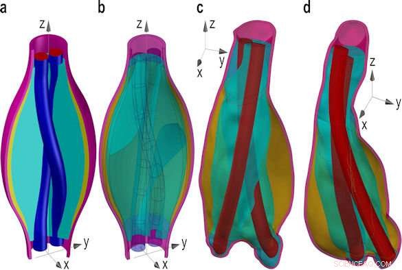 New Mathematical Model Advances Understanding of Endovascular Aneurysm Sealing Response