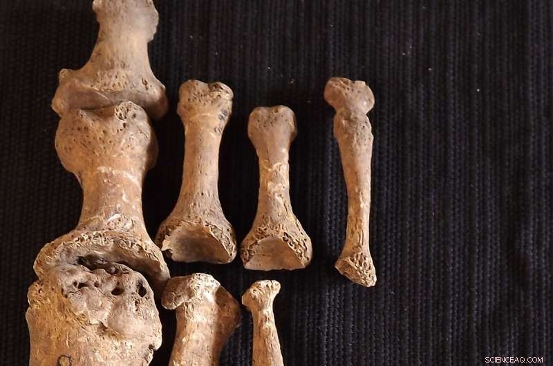 New DNA Study Reveals Unexpected Diversity of Medieval European Leprosy Strains