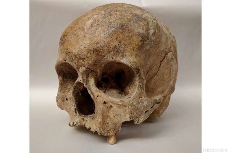 New DNA Study Reveals Unexpected Diversity of Medieval European Leprosy Strains