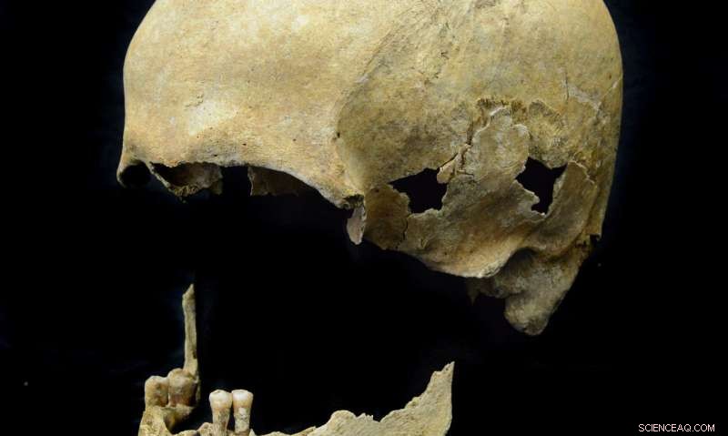 Decoding Stone Age Hepatitis B: Genomic Reconstruction from Karsdorf, Germany