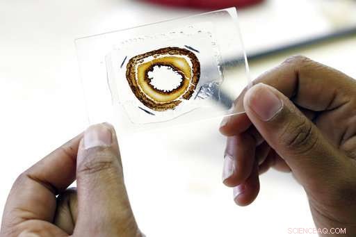 Up to 7,000 Unidentified Bodies Discovered at Former Mississippi State Asylum