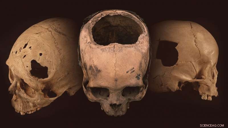 Peru s Ancient Trepanation: Uncovering the World s Largest Collection of Cranium Holes