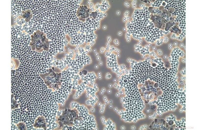 Discover the Award-Winning Beauty of Crab Blood Parasites – 2018 Research as Art Winner