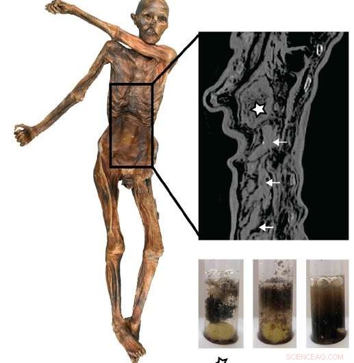 5,300-Year-Old Iceman s Final Meal Reveals Ancient High-Fat Diet