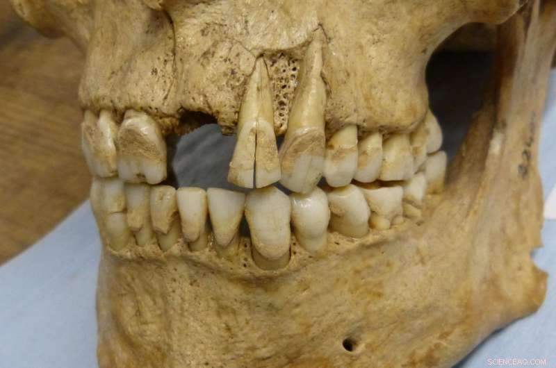 New Study of British Teeth Reveals Ancient Diet Secrets