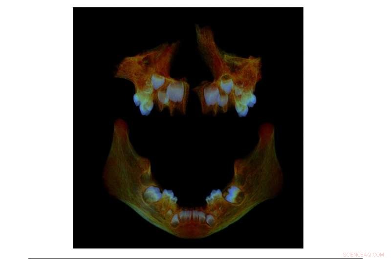 How Anglo‑Saxon Children’s Teeth Reveal Modern Health Risks