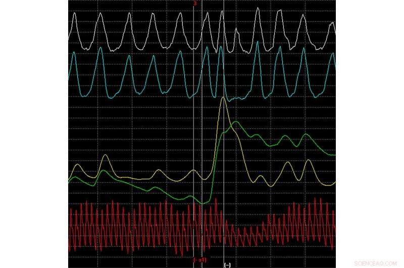 The Reliability of Polygraphs: Can They Truly Detect Lies?
