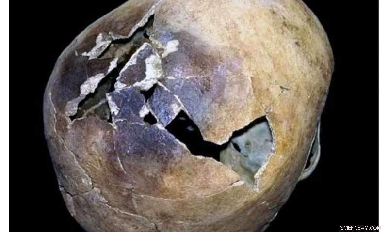 New Study Reveals How Vesuvius Pyroclastic Flows Vaporized Body Fluids, Causing Fatal Burns