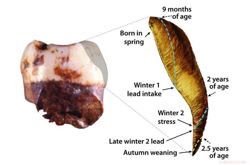 First Evidence of Lead Exposure in a 250,000-Year-Old Neanderthal Child Revealed by Tooth Analysis