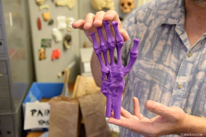 VCU Lab Brings Civil War Skeletons to Life with 3‑D Scanning