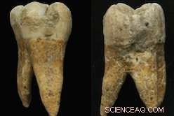 Unearthing Ancient Diets: How Prehistoric Teeth Reveal Neolithic Lifestyle